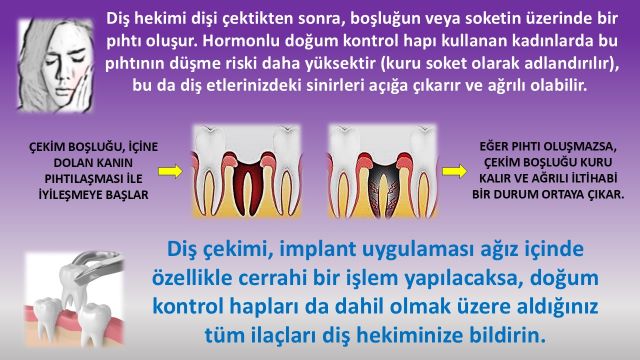 doğum kontrol hapı kullanan kadınlarda diş çekimi sonrası oluşabilecek sorunlar