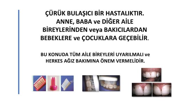 Çürükle ilişkili bakterilerin aile bireyleri ve bakıcılardan çocuklara geçişini anlatan ağız bakımı görseli