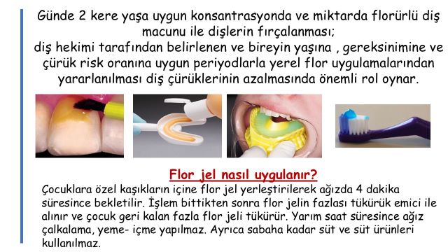 Çocuklarda florürlü diş macunu kullanımı ve profesyonel flor uygulamalarını gösteren bilgilendirme